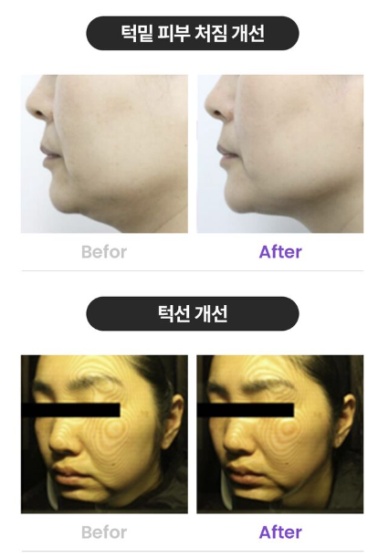 코어 임팩트 효과