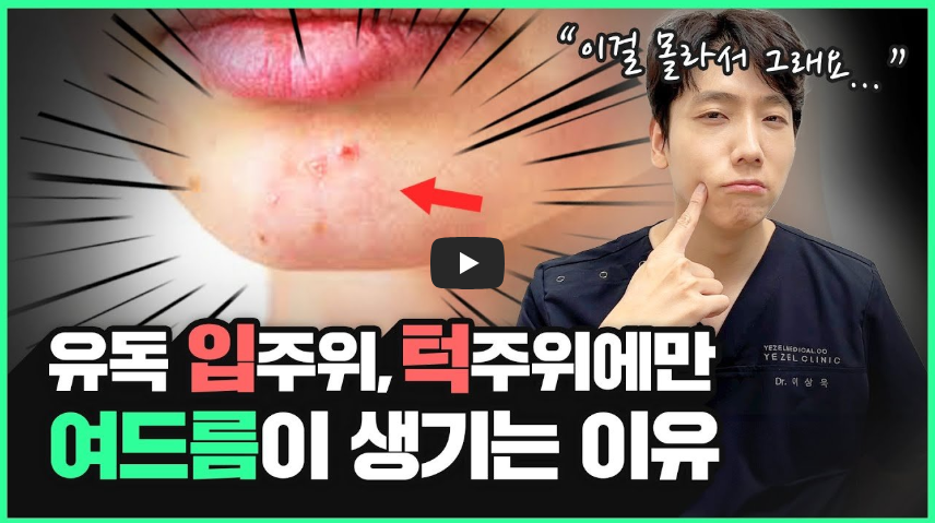 턱여드름 성인여드름 여드름관리 피부트러블 클렌징루틴