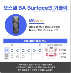 오스템임플란트 가격