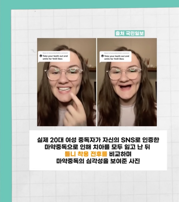 구토로 위산이 역류해 치아가 녹아버렸다.