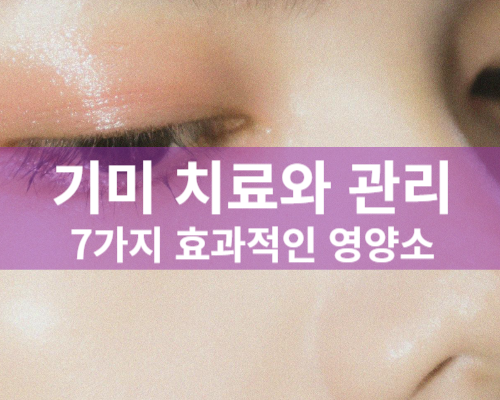 기미 치료 및 관리