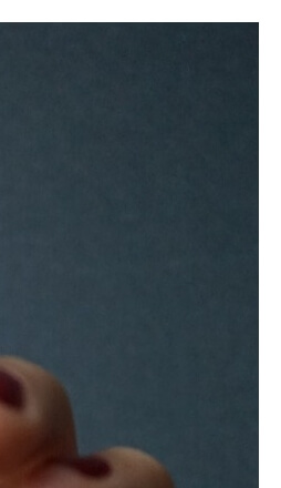 손가락수포대처법