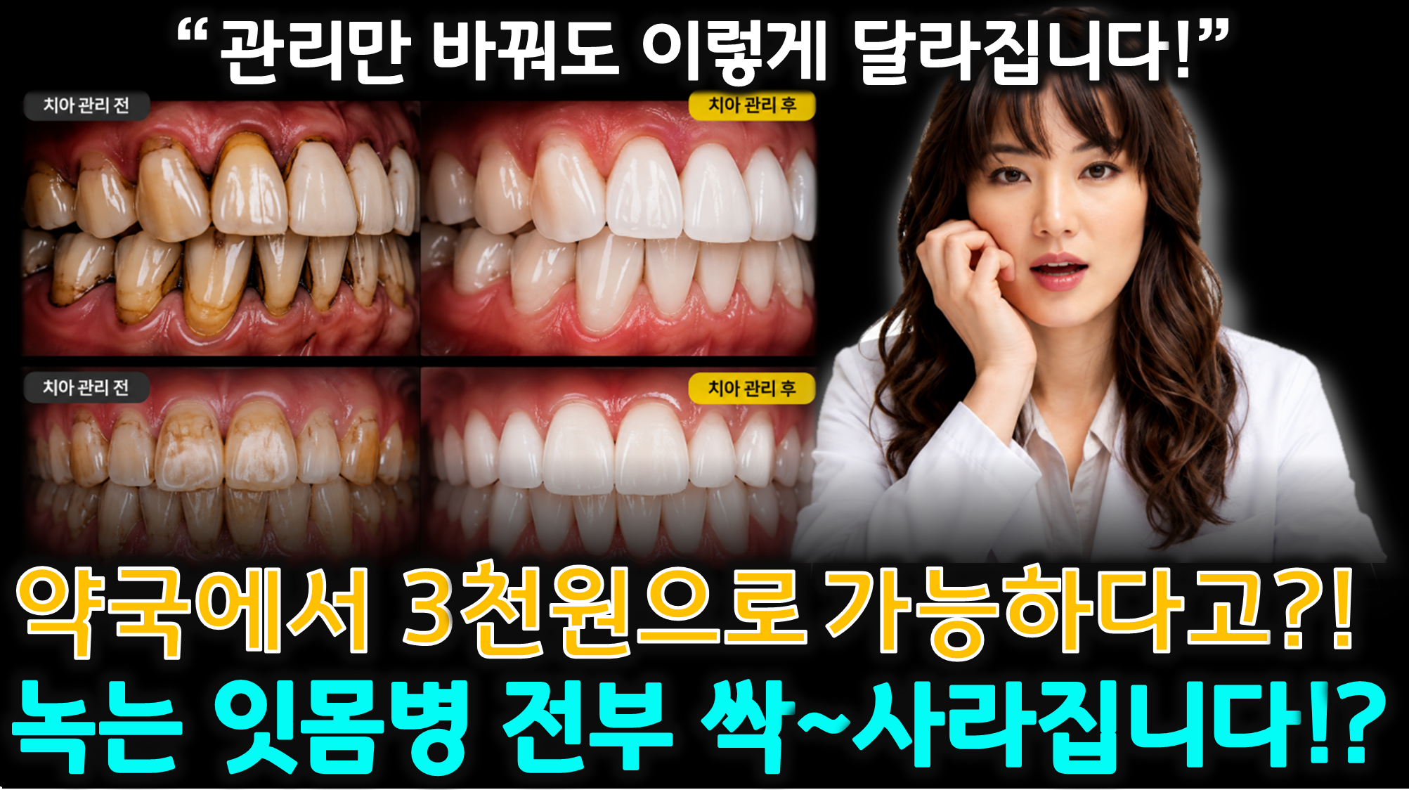 올바른 양치질 (불소농도, 칫솔선택, 잇몸관리)