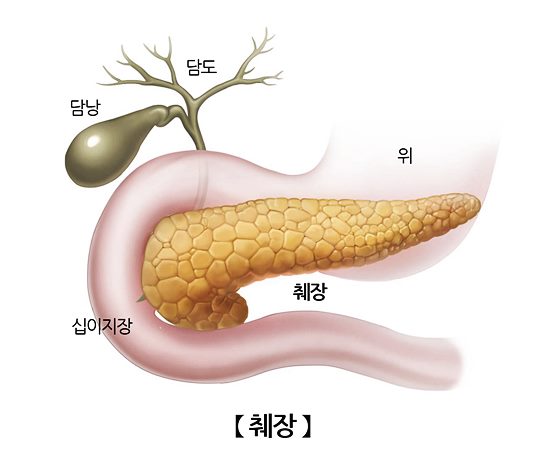 췌장염 초기증상