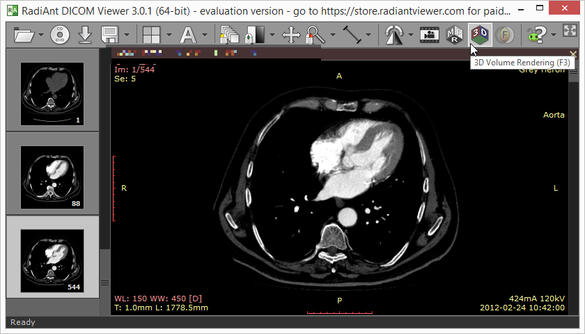 RadiAnt DICOM Viewer (Windows 전용)