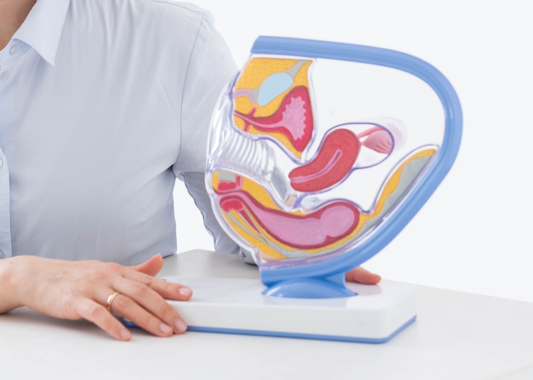 Irritable bowel syndrome
