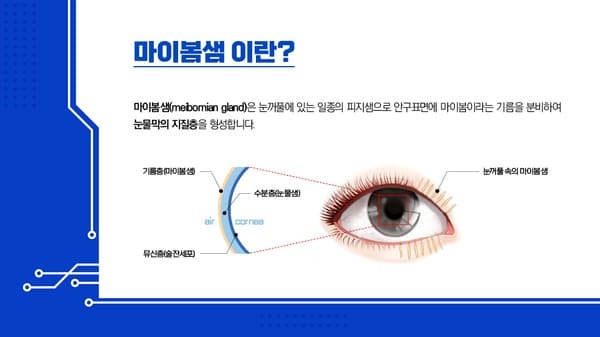 마이봄샘 설명 사진