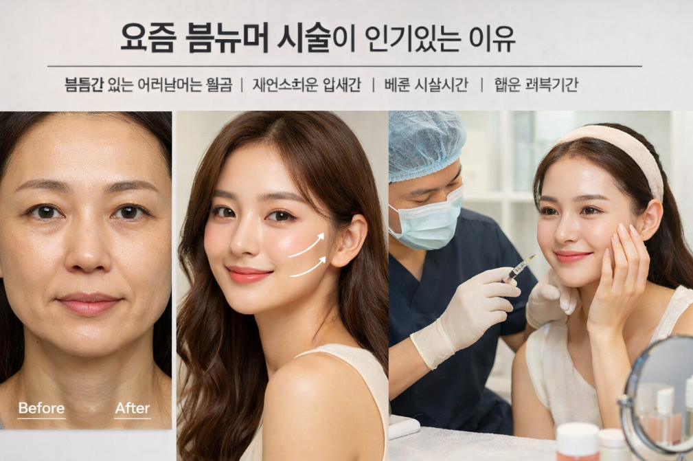 볼뉴머 시술 뜻, 지금 핫한 이유 3가지