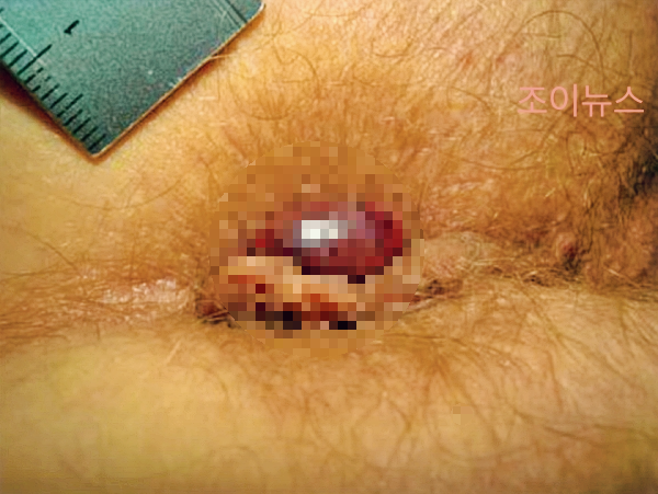 외치핵_출처:유튜브응꼬형