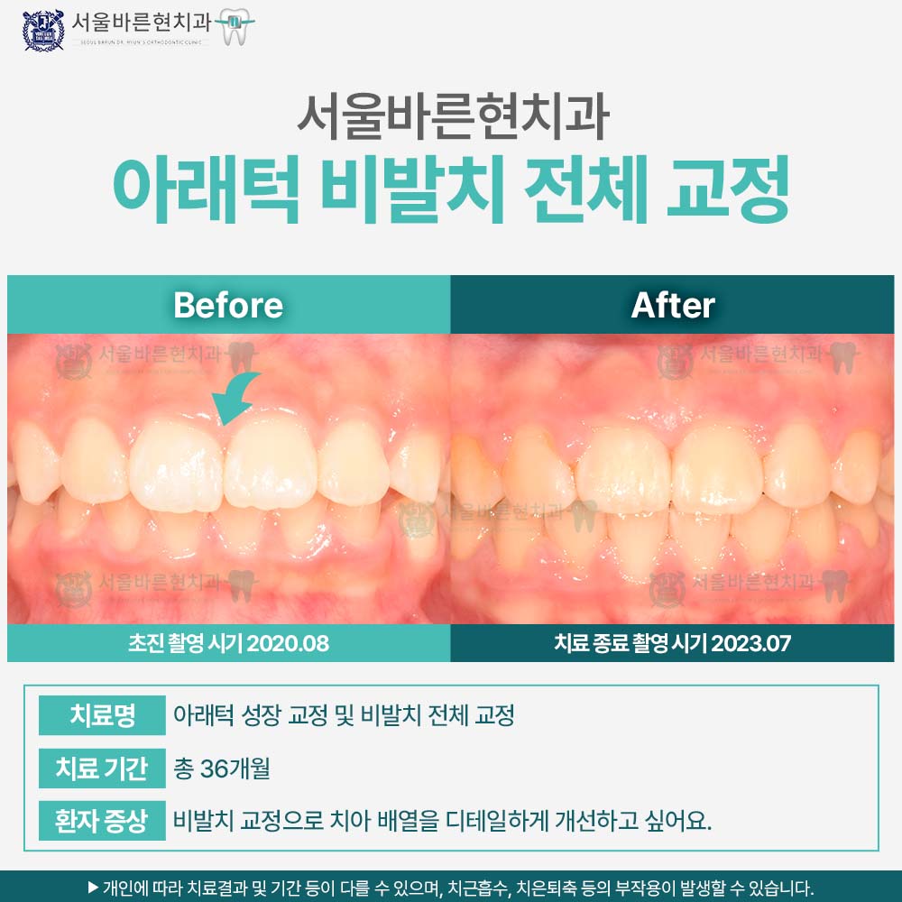 마린시티교정치과