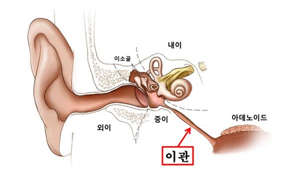 아이유가 걸린 이관개방증 증상&#44; 원인&#44; 치료