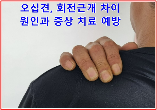 오십견 회전근개 차이 원인과 증상 치료 예방