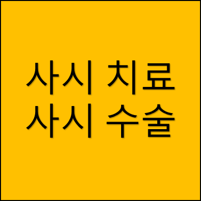 사시 치료와 사시 수술 썸네일