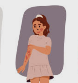 대상포진 초기증상 치료방법 예방법 총정리