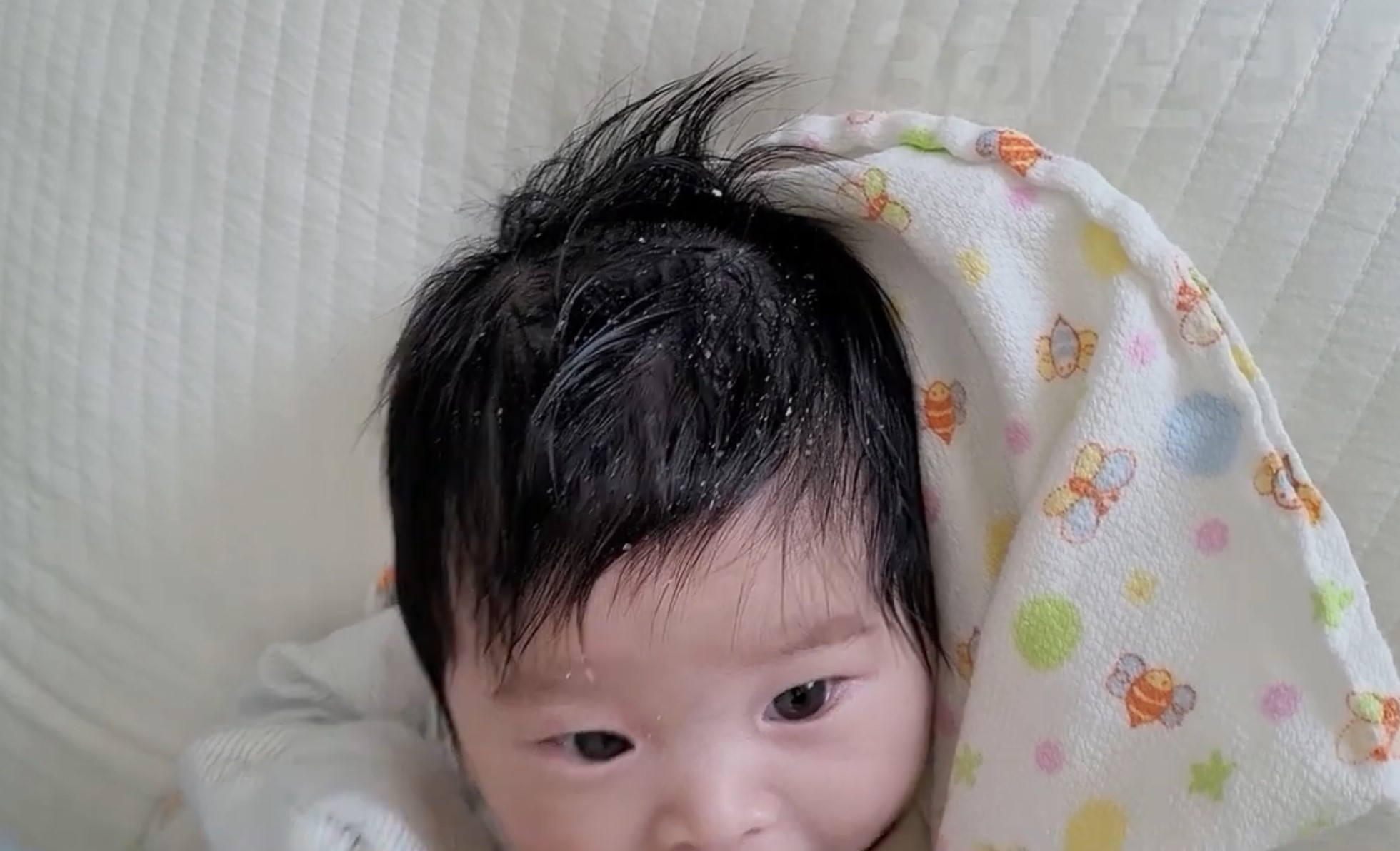 아기 노란딱지, 지루성 피부염 어떻게 괸리 해야 하나?