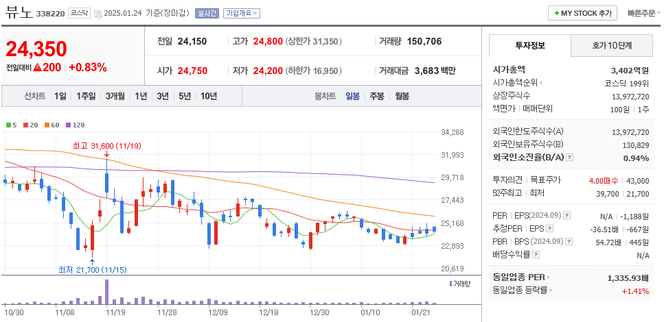 의료용 로봇 관련주 뷰노 주기 차트