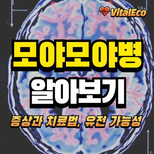 모야보야병 알아보기