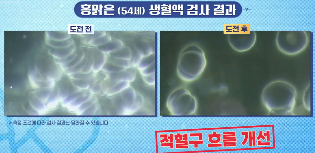 카무트 효소 효능