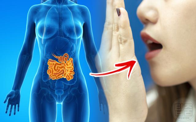 입냄새 심한 이유 입냄새 원인 질환 장폐색