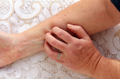 꽃가루 알레르기 증상