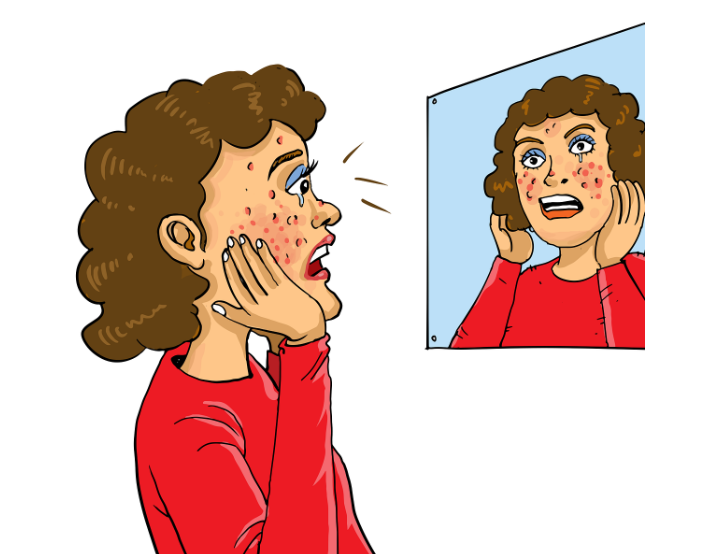 여성이 얼굴에 잔뜩 난 여드름을 거울로 보면서 놀라는 그림입니다.
