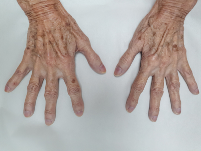 손톱 건강관리 TIP 7가지 건강한 손톱