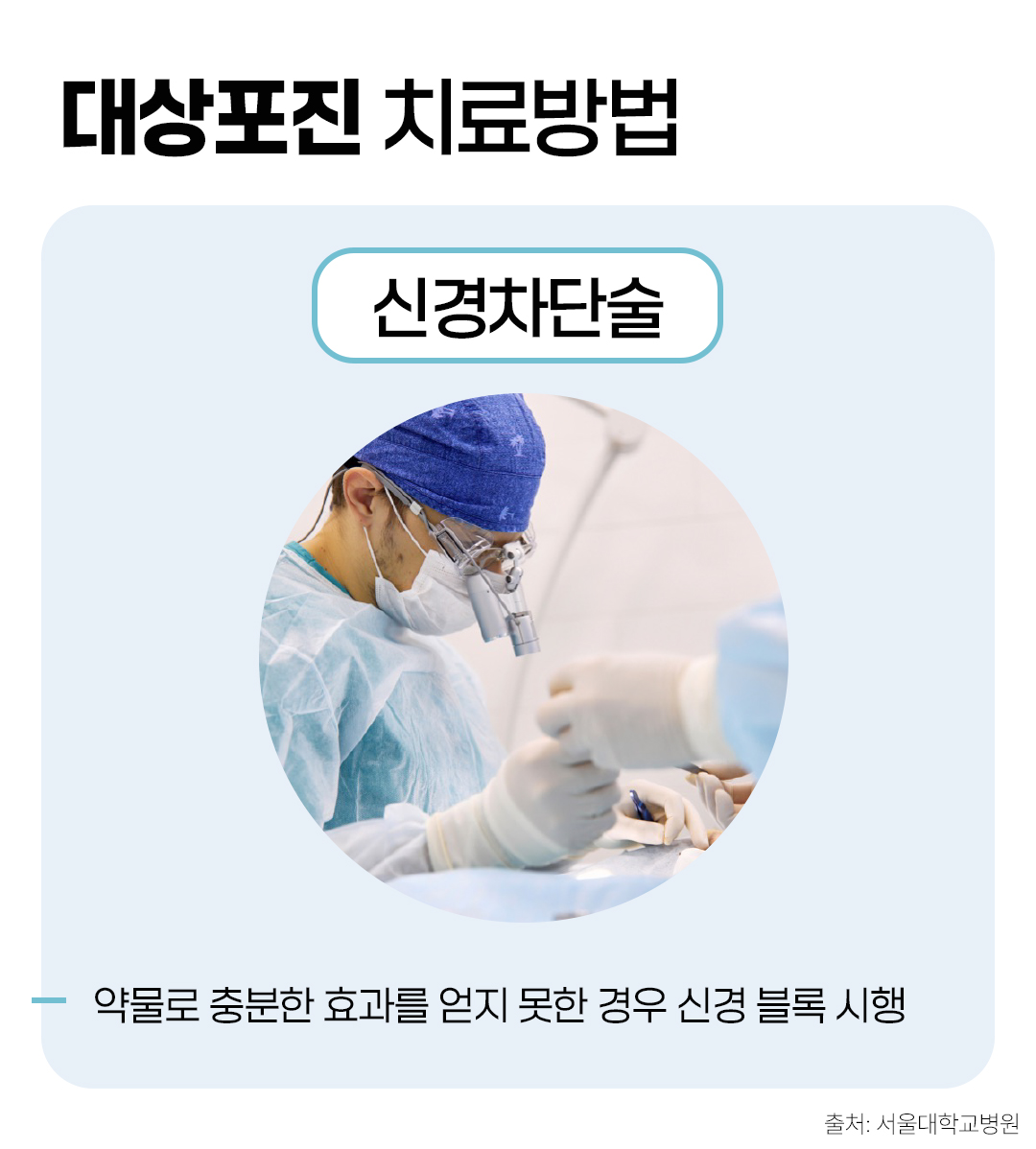 #대상포진의 치료방법 3. 신경차단술
