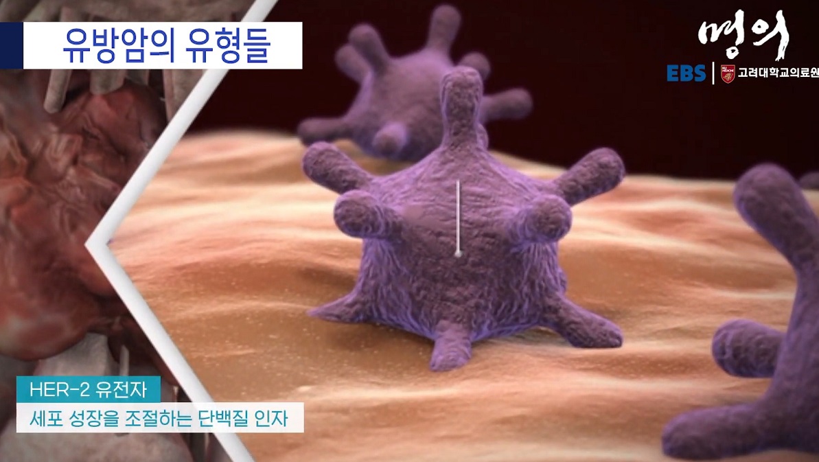 유방내분비외과-우상욱-교수