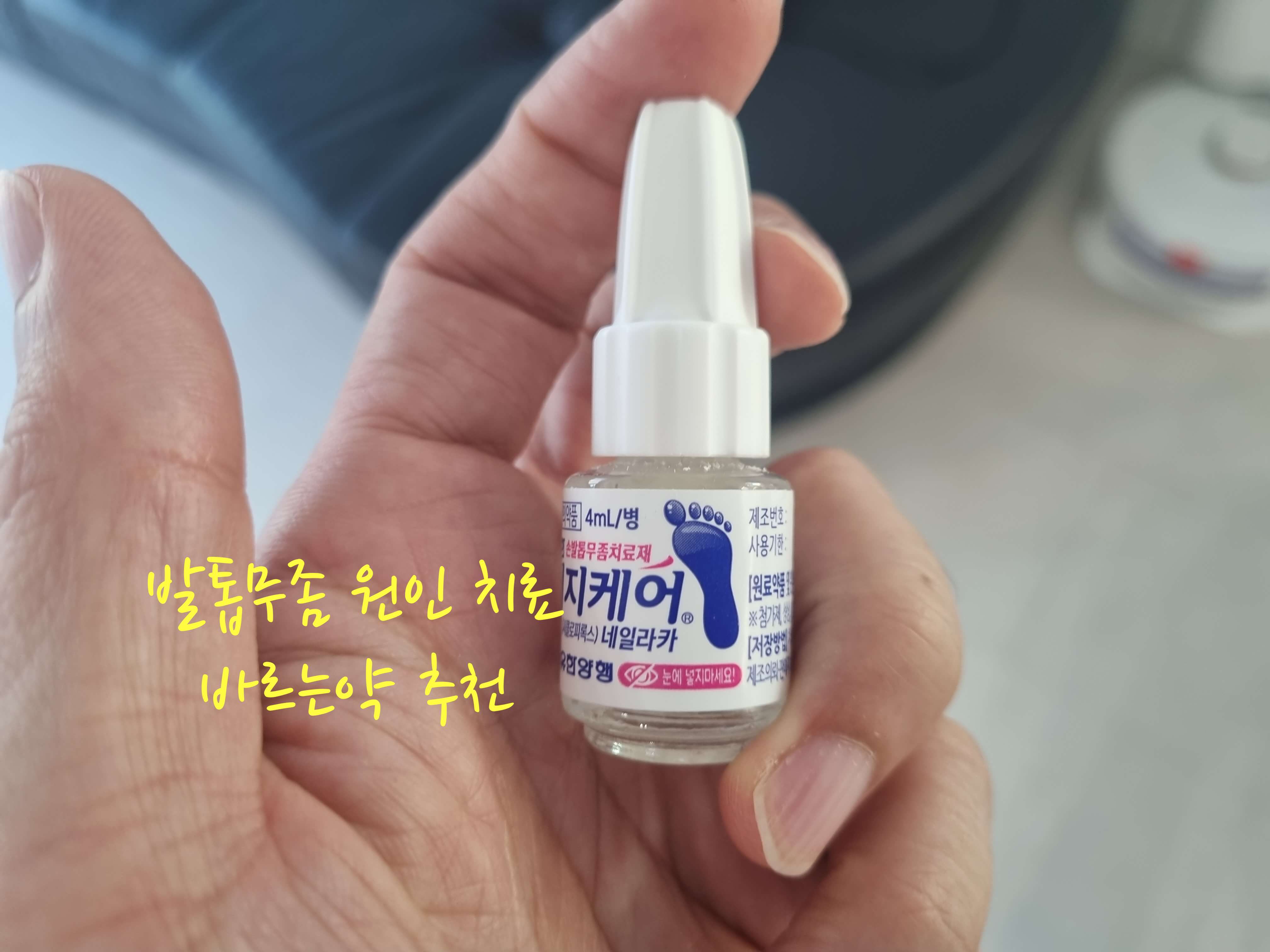 발톱무좀