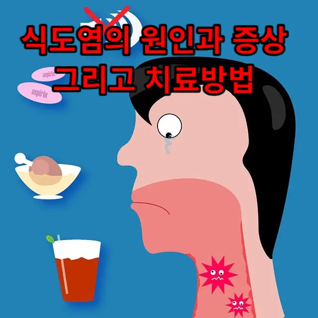 식도염(Esophagitis)의 원인과 증상 그리고 치료방법