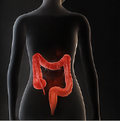 대장암 초기증상