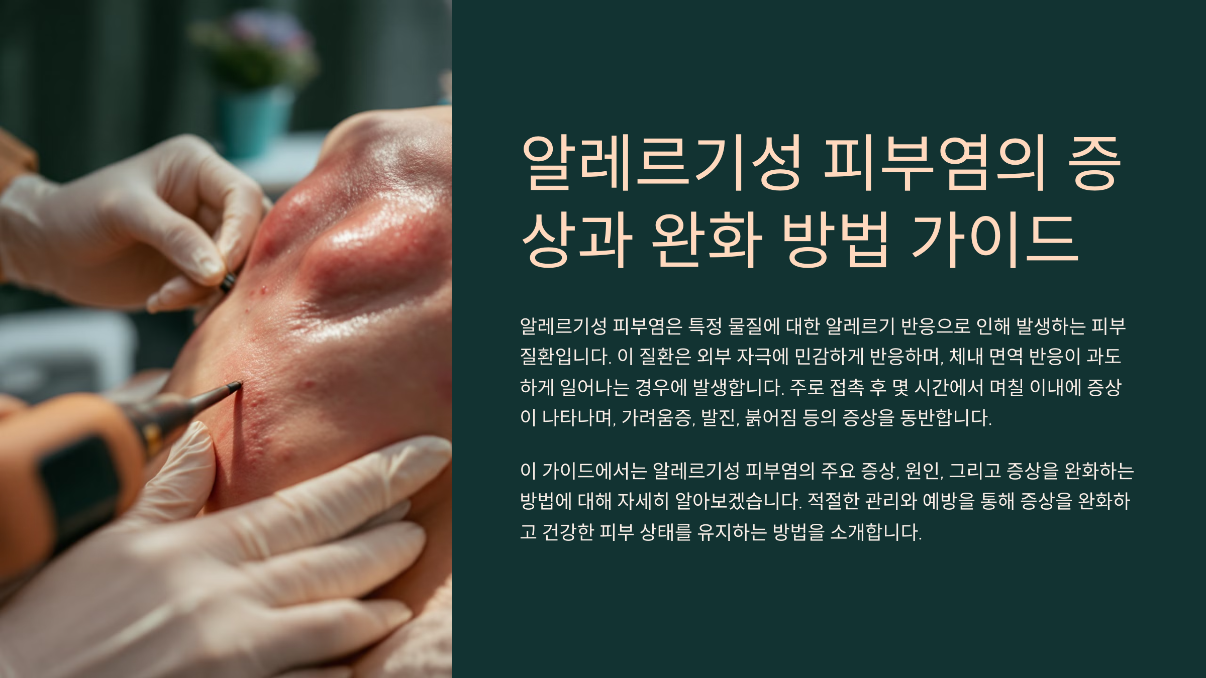 알레르기성 피부염의 증상과 완화 방법 가이드