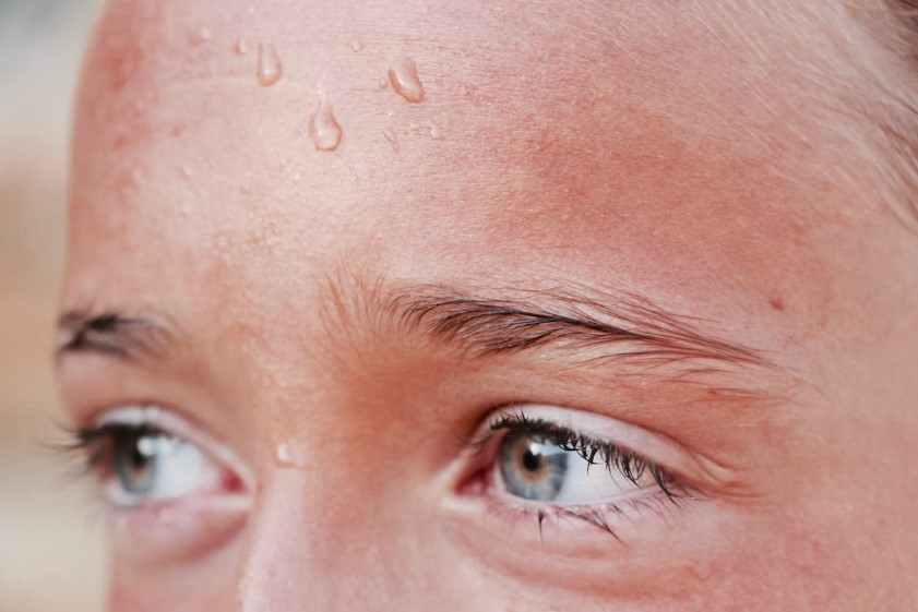 여름철 피부질환 및 관리방법