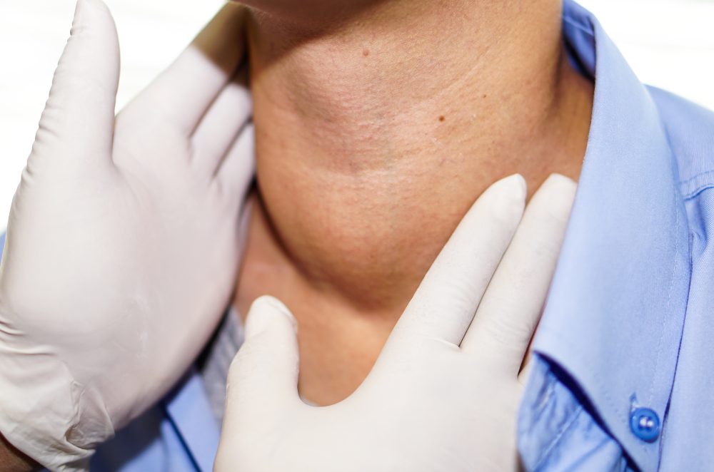 alt="갑상선 기능 항진증(과잉 갑상선 기능 항진증)"