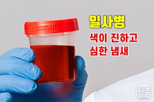 더위 먹은 증상 소변색 더위 먹었을때 대처 회복기간