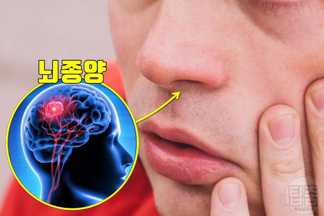 암 초기증상,뇌종양 증상