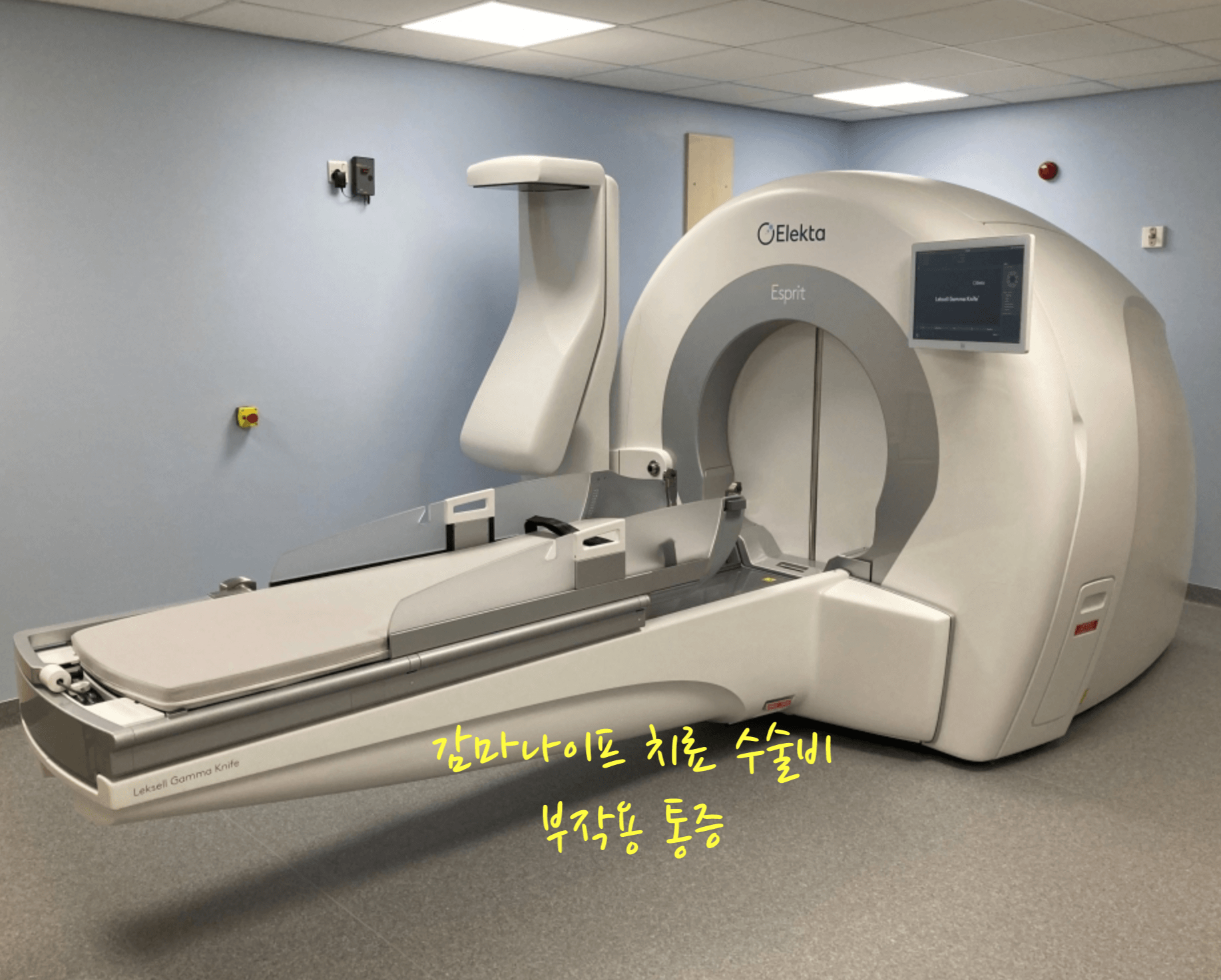 감마나이프 치료