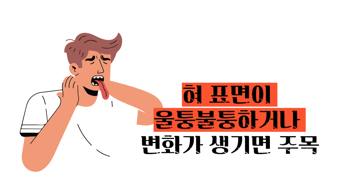 설암 초기증상