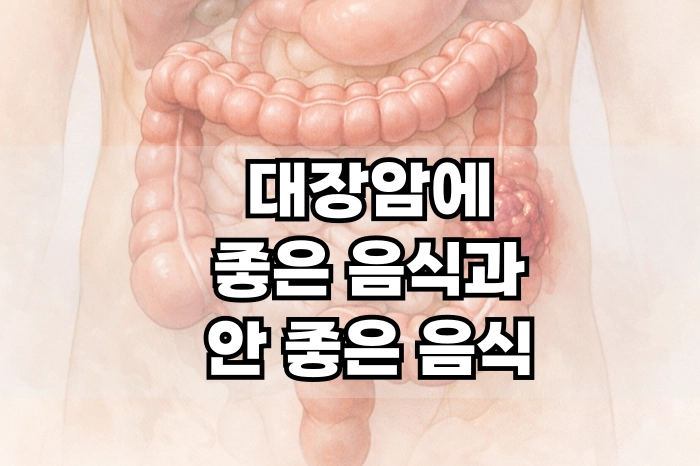대장암에 좋은 음식과 안 좋은 음식