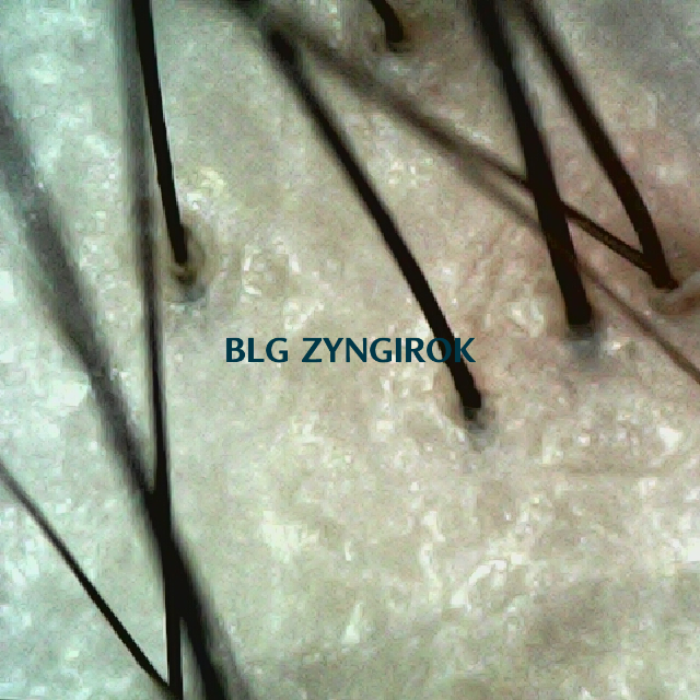 피나모아 복용 15주차 두피 사진 - 정수리와 이마 사이 모습이다.