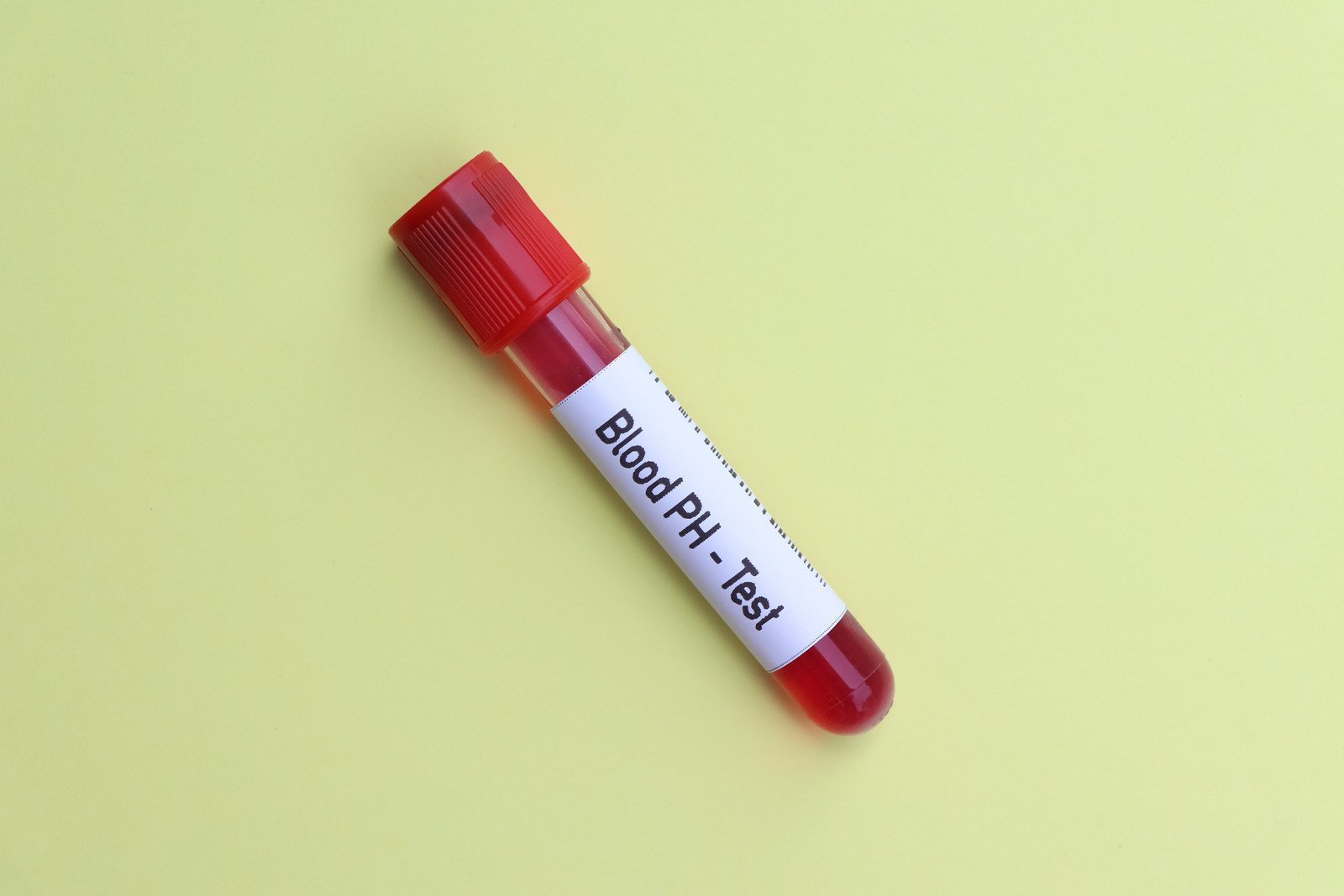 24시간 식도 pH 검사 (24-Hour Esophageal pH Monitoring)
