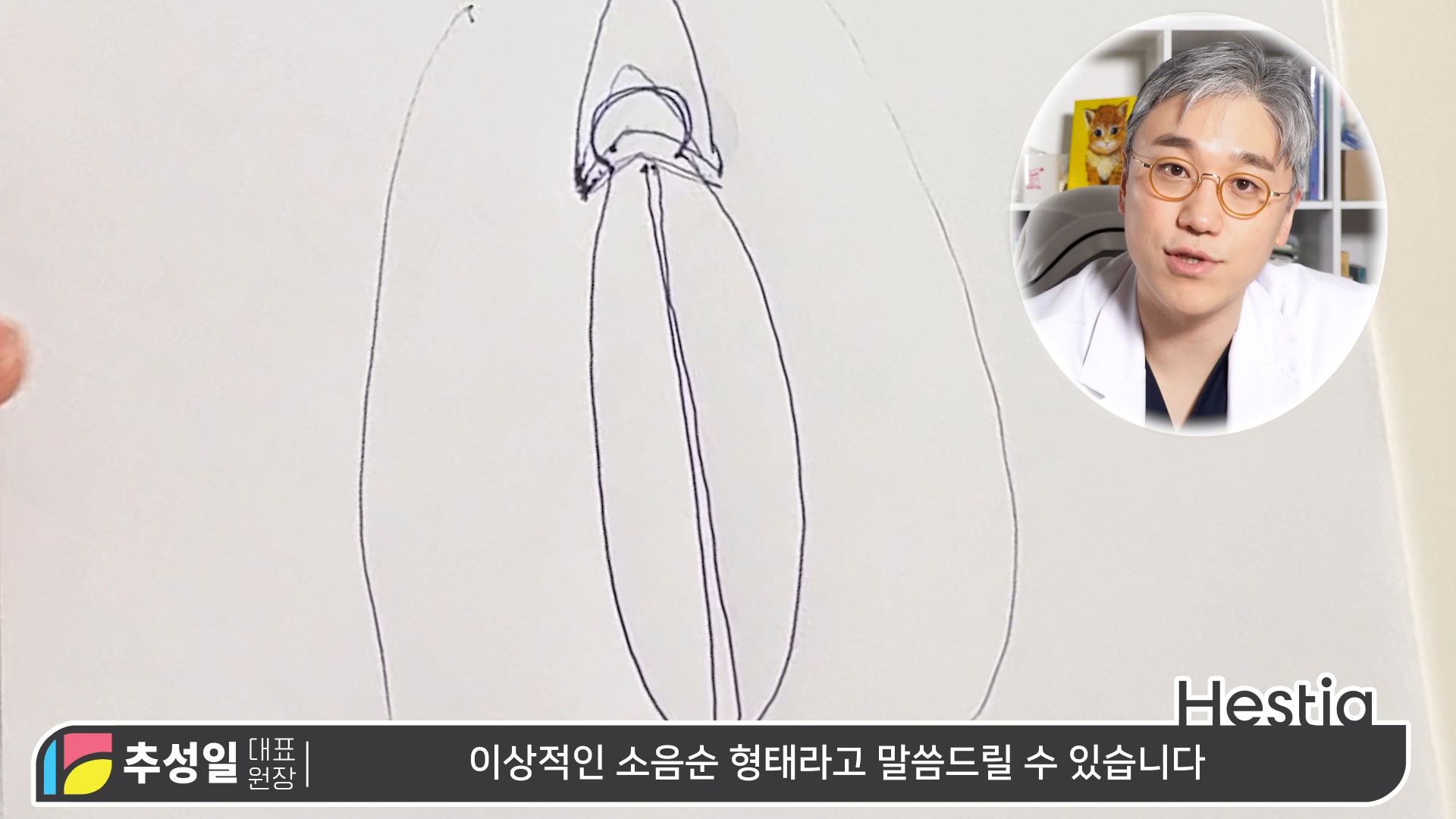  이상적인 소음순이란?