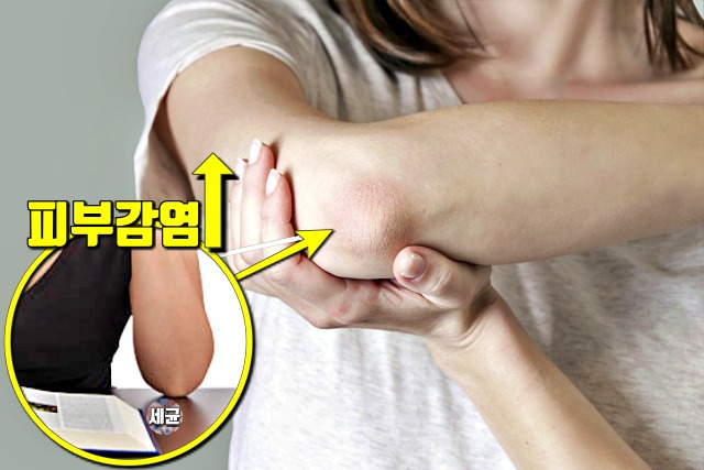 세균 많은 곳 신체부위,팔꿈치