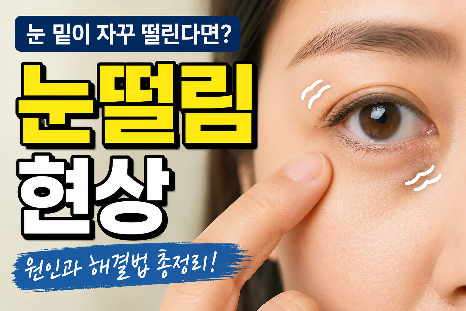 눈 떨림 증상을 경험하는 여성