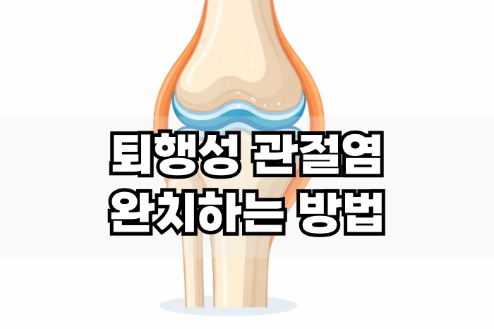 퇴행성 관절염 완치하는 최고의 비법