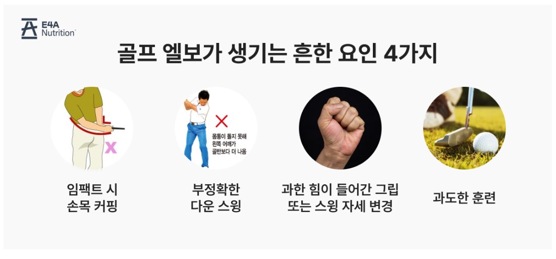 골프 엘보 원인 요인