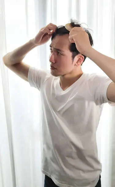 탈모약 부작용