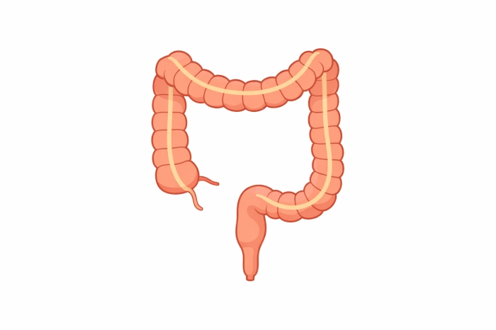 대장암 초기증상