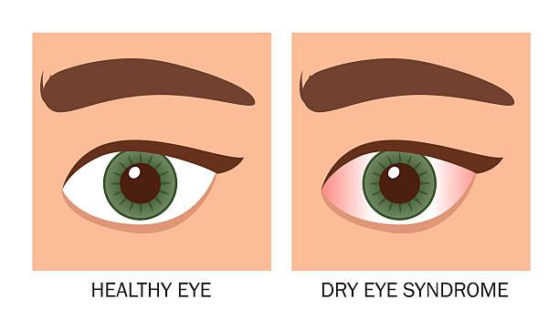 눈에서 진물나오는 이유에 대한 심화 분석