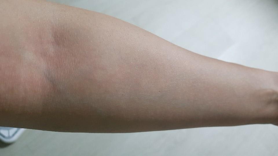 팔 모습 사진